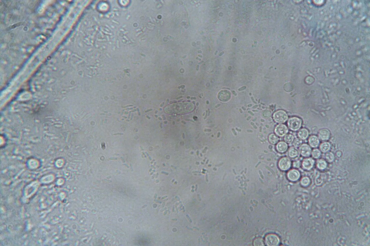 saltwater nitrogen cycle — bacteria microscope