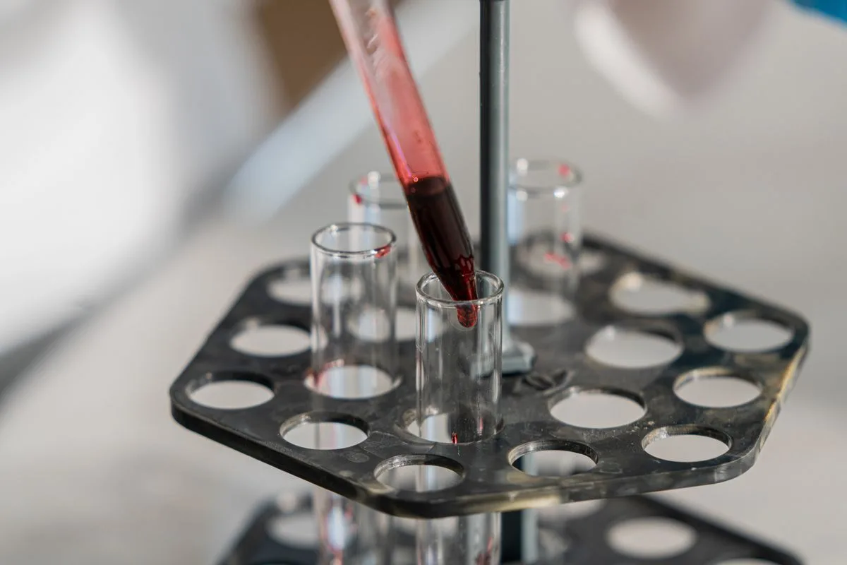 test reef aquarium water — water sample